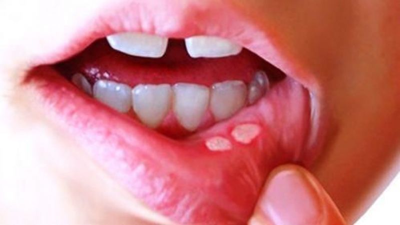 Diş hekimleri diyabet teşhisine katkı sağlayabiliyor