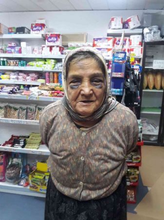 Demir çubukla 73 yaşındaki eşini döven adam hakkında yasal işlem başlatıldı