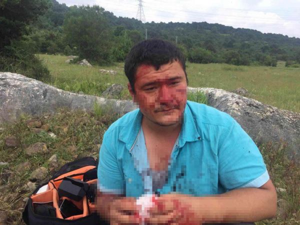 Lütfü Türkkan’ın adamlarının darp ettiği muhabirin yüzündeki iz bir ömür kalacak